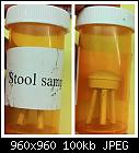 Stool sample-stool-sample-jpg